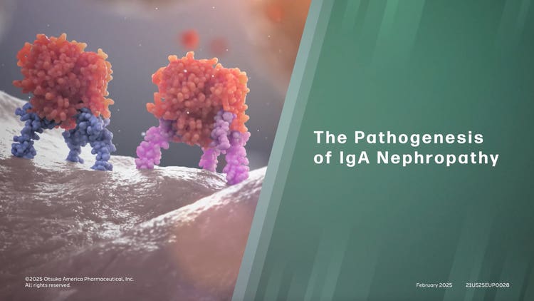 The pathogenesis of IgA Nephropathy